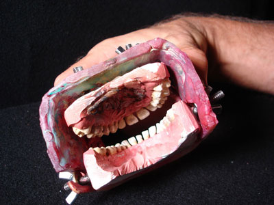 Inside mouth